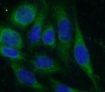 HVCN1 Rabbit Polyclonal Antibody