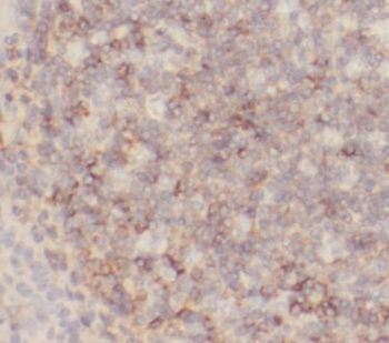 HVCN1 Rabbit Polyclonal Antibody