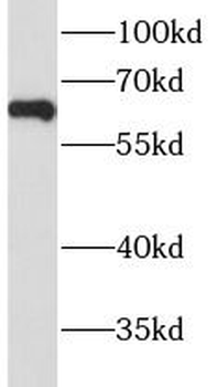 HYAL4 Rabbit Polyclonal Antibody