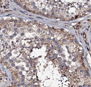 HYAL4 Rabbit Polyclonal Antibody
