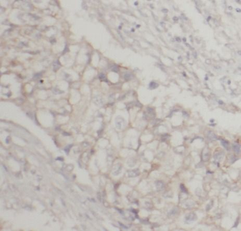 ICAM1 Rabbit Polyclonal Antibody