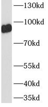 ICAM1 Mouse Monoclonal Antibody