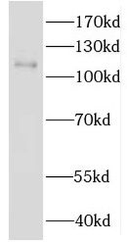 IDE Rabbit Polyclonal Antibody