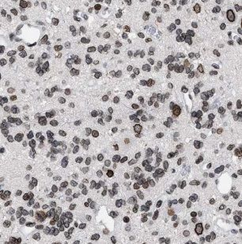 IDH1 Rabbit Polyclonal Antibody