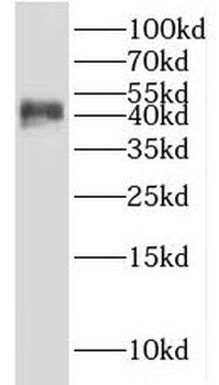 IDH1 Rabbit Polyclonal Antibody