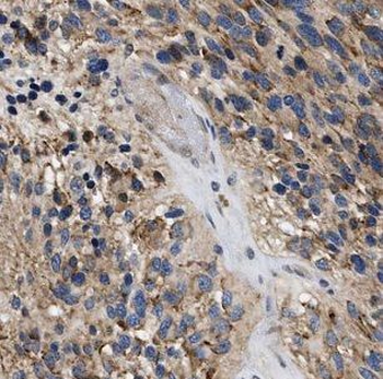 IDH1 Rabbit Polyclonal Antibody