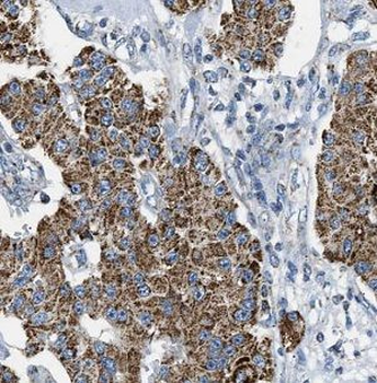 IDH2 Rabbit Polyclonal Antibody