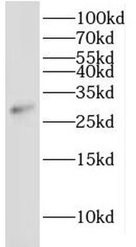 IDI2 Antibody