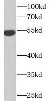 IFIT1 Rabbit Polyclonal Antibody