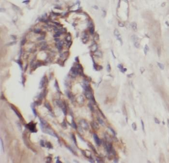 IFIT1 Rabbit Polyclonal Antibody