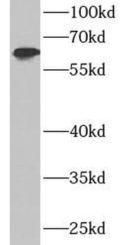 IFIT3 Antibody