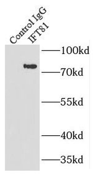 IFT81 Rabbit Polyclonal Antibody