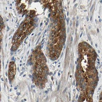 IFT81 Rabbit Polyclonal Antibody