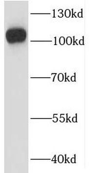 IGHMBP2 Antibody