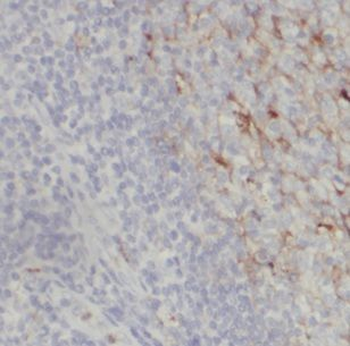 JCHAIN Rabbit Polyclonal Antibody