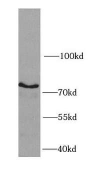 IKBKB Rabbit Polyclonal Antibody