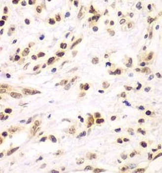 IKBKB Rabbit Polyclonal Antibody
