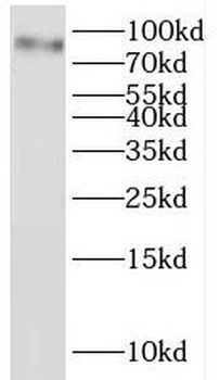 IKBKB Rabbit Polyclonal Antibody