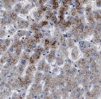 IKBKB Rabbit Polyclonal Antibody