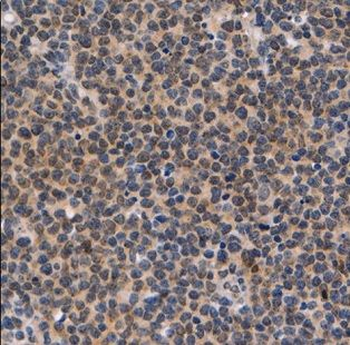 IKZF1 Rabbit Polyclonal Antibody