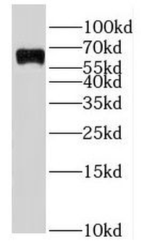 IKZF3 Antibody