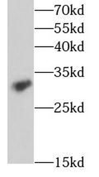 IL17RB Antibody