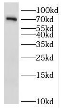 IL1RAPL1 Antibody