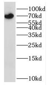 IL3RA Antibody