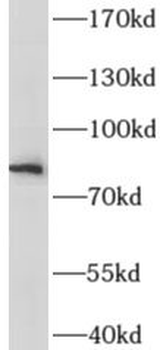 IL6R Antibody