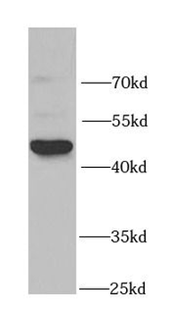ILK Rabbit Polyclonal Antibody