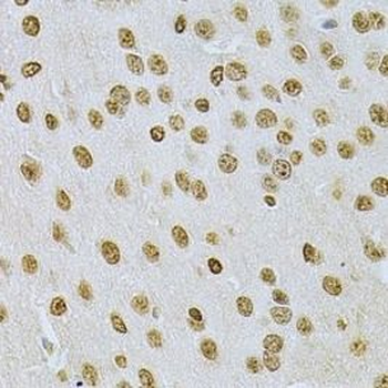 ILK Rabbit Polyclonal Antibody