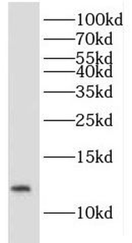 IMMP2L Rabbit Polyclonal Antibody
