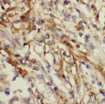 IMMP2L Rabbit Polyclonal Antibody