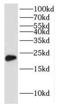 IMP3 Rabbit Polyclonal Antibody