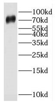 SPPL2C Antibody