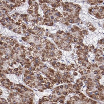 SPPL2C Rabbit Polyclonal Antibody