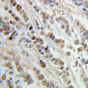 ING5 Rabbit Polyclonal Antibody