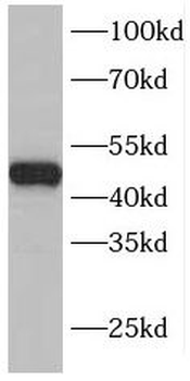 INHBA Rabbit Polyclonal Antibody
