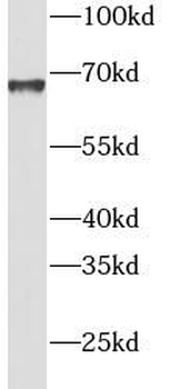 INPP5E Rabbit Polyclonal Antibody