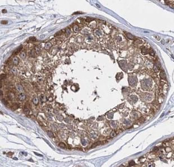 INPP5E Rabbit Polyclonal Antibody