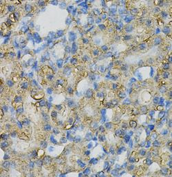 INPP5J Rabbit Polyclonal Antibody