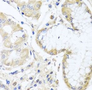 INPP5K Rabbit Polyclonal Antibody