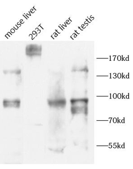 INSR Rabbit Polyclonal Antibody