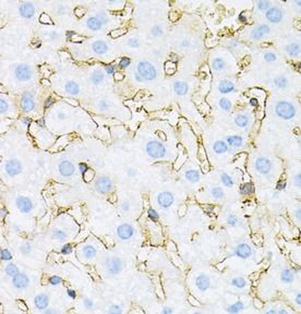 INSR Rabbit Polyclonal Antibody