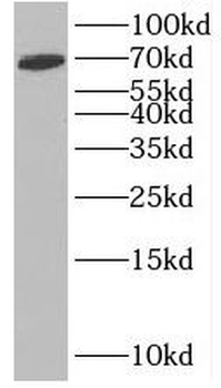 INTS11 Antibody