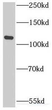 INTS3 Antibody