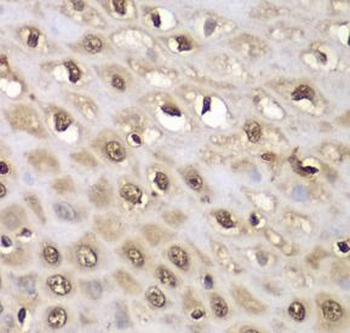 INTS5 Rabbit Polyclonal Antibody