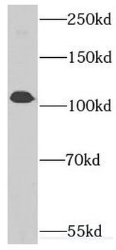 INTS7 Antibody