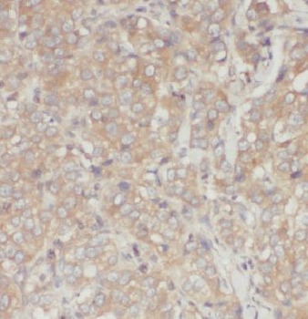 INVS Rabbit Polyclonal Antibody
