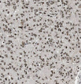 IPO13 Rabbit Polyclonal Antibody